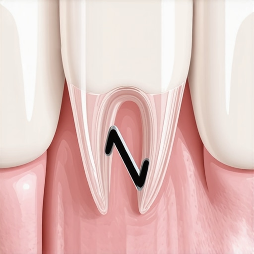 Bioclear Matrix for Black Triangle Repair A clear dental mold being used to shape composite resin and close a gap between two teeth.